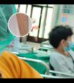 308光疗医院怎么收费