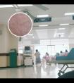 希兰308准分子治疗仪