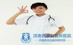老人得了白癜风该怎么治疗 老人得了白癜风该怎么治疗